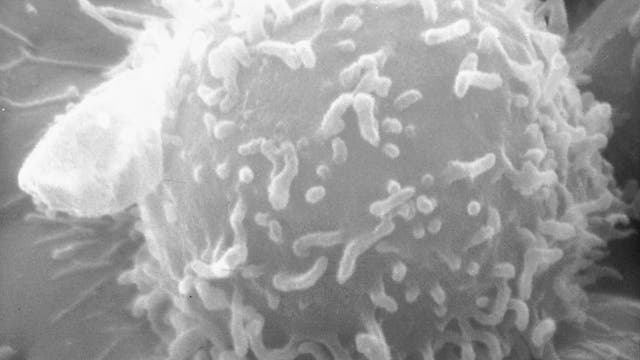 T-Lymphozyt des Menschen