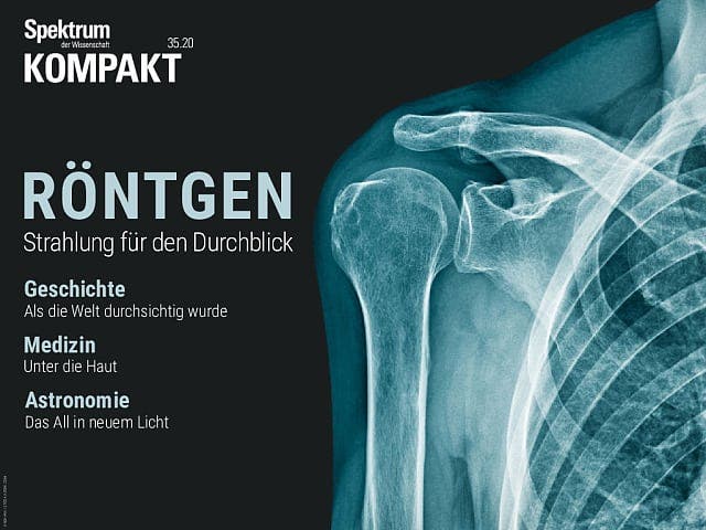  Röntgen – Strahlung für den Durchblick