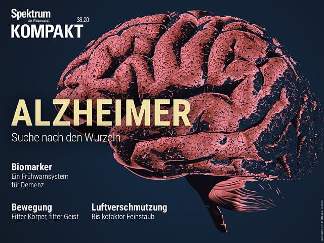 Alzheimer – Suche nach den Wurzeln