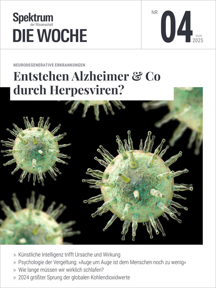 Spektrum - Die Woche - 4/2025 - Entstehen Alzheimer & Co durch Herpesviren?